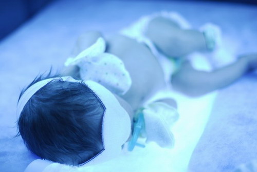 Jaundice