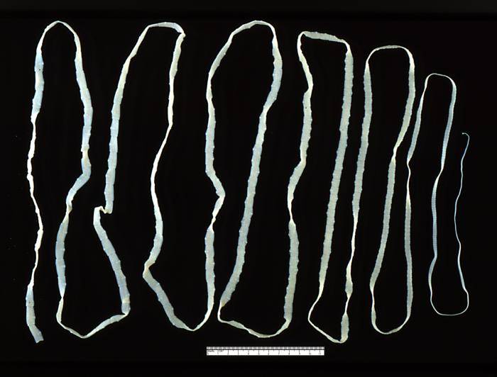 intestinal worms in humans. Adult worms may be over 20 m