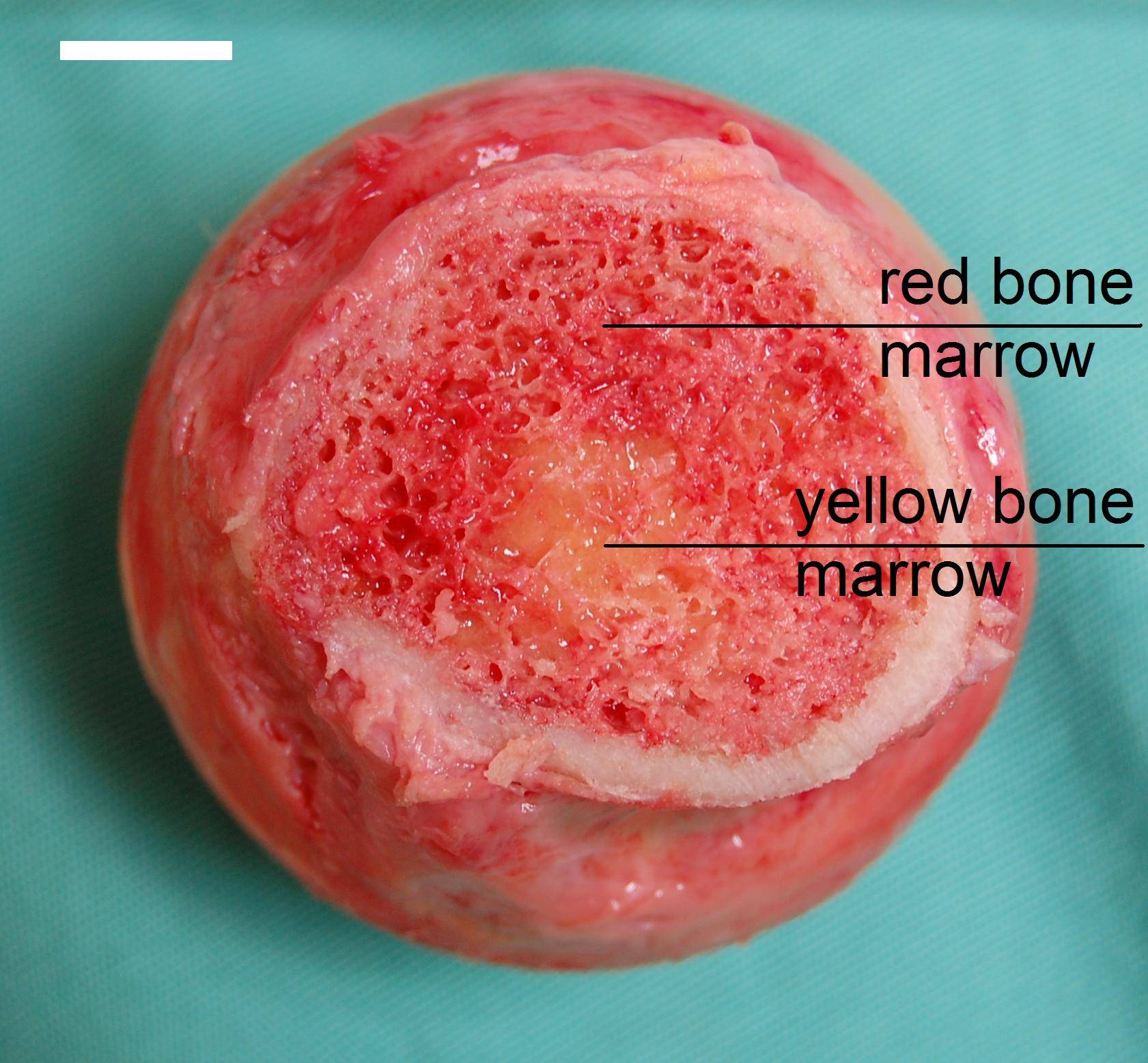 Image result for marrow in bones photos