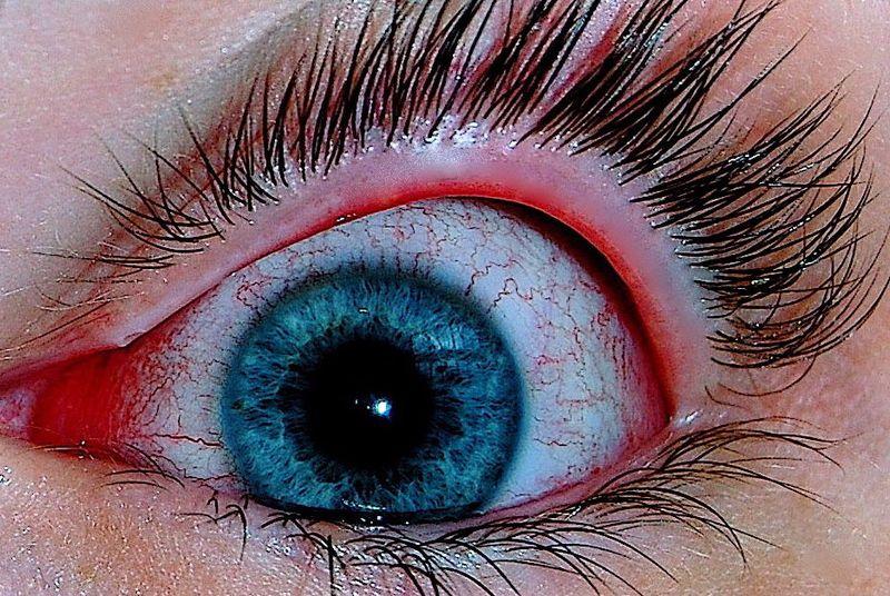 What are the causes of pain in the eye?