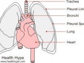 fluid in the lungs causes