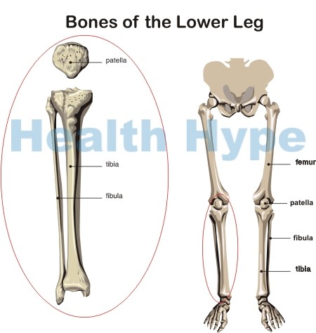 Shin Pain and Shin Splints Causes, Symptoms and Treatment | Healthhype.com