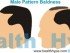 Male pattern baldness signs