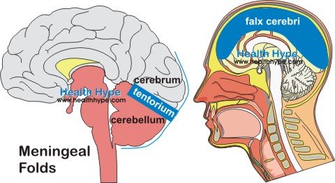 herniation of brain. Types of Brain Herniation