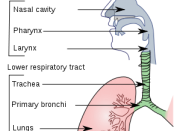 pilonidal sinus remedy australia