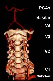 vertebral artery segments