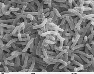 Cholera_bacteria