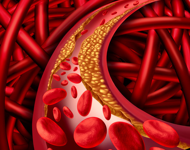 Blood Cholesterol