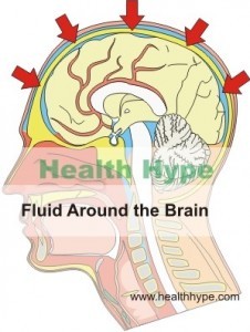 Swelling of the Brain (Cerebral Edema) Types and Causes - Healthhype