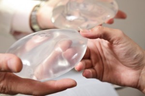 Picture of Breast Implants
