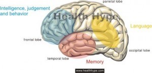 dementia brain changes
