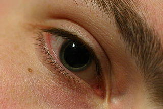 dilated_pupils