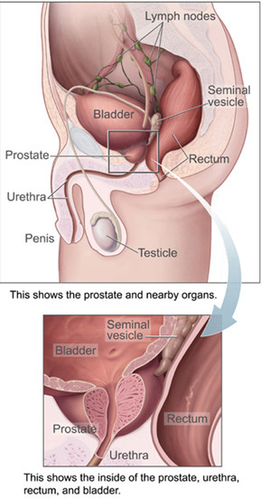 enlarged_prostate_gland
