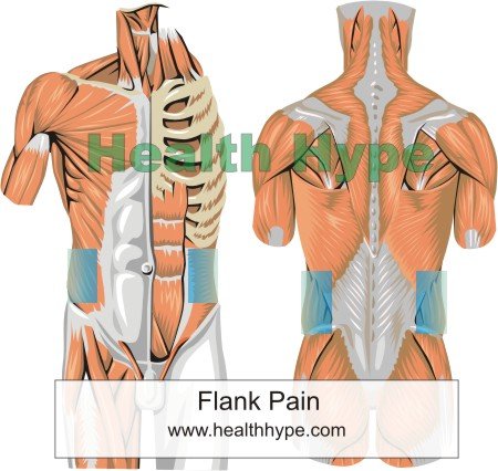 Symptoms - Flank pain