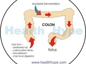 Watery Flatus (Wet Farts, Flatulence) Causes, Symptoms, Treatment ...
