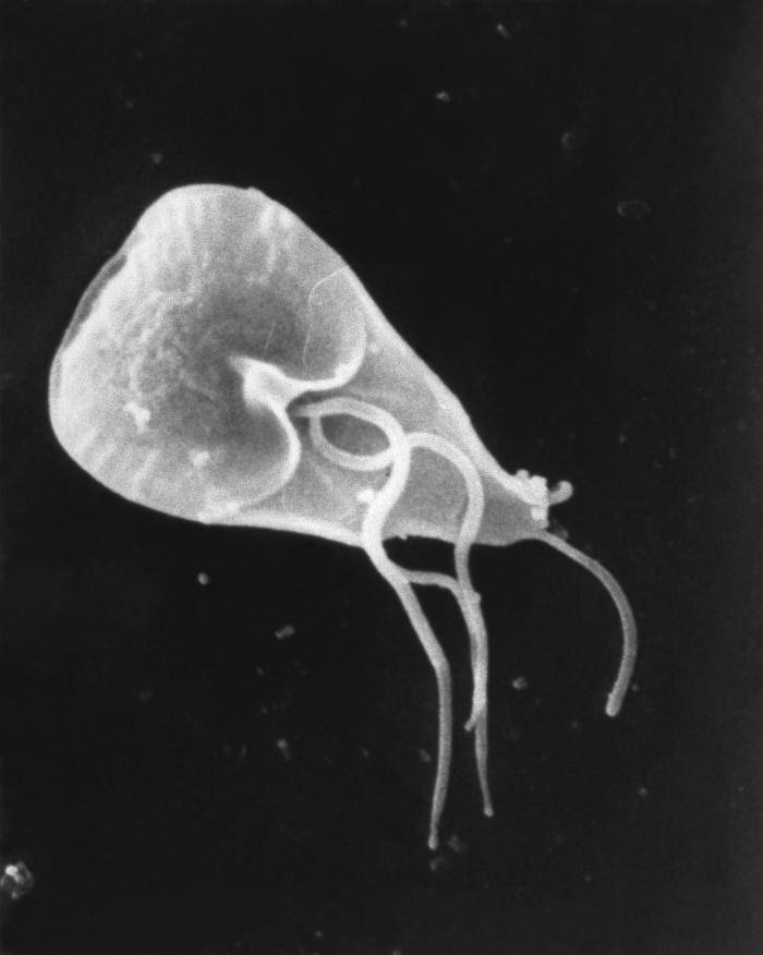 Giardia under electron microscope