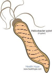 H.pylori stomach bacteria
