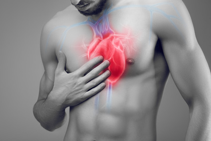 heart attack coronary arteries