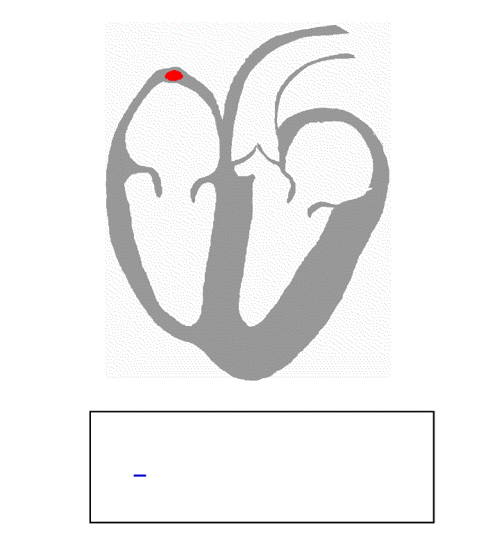 Heart contraction animation