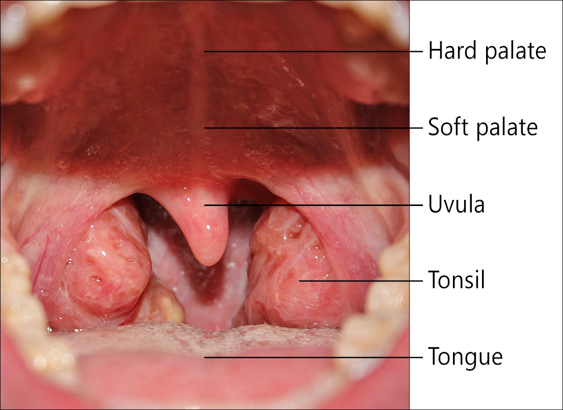 Phto of pharynx, soft palate, lingula and tonsils