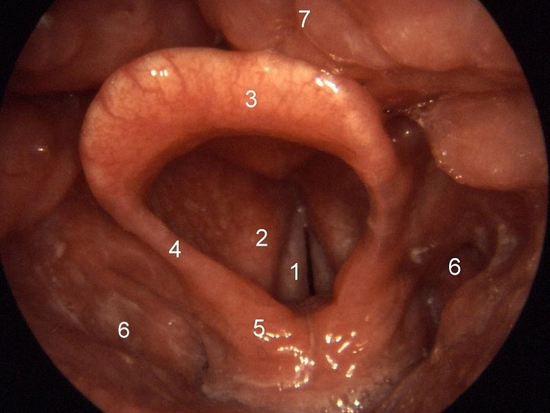 Larynx as seen during laringoscopy
