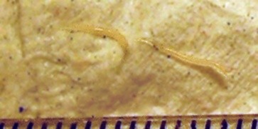 pinworms (females)