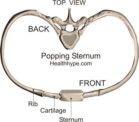 To causes sternum what 😱 pop the Strenum Pain: