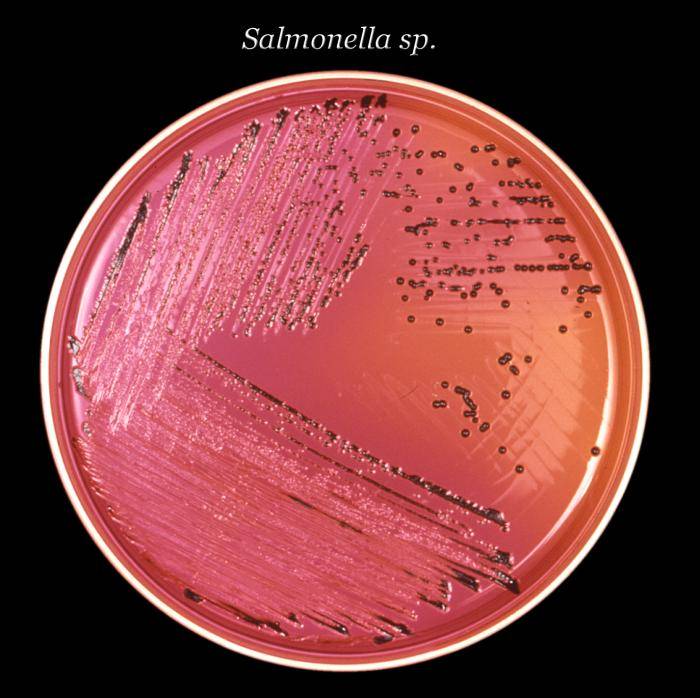 Stool culture test showing Salmonella colony
