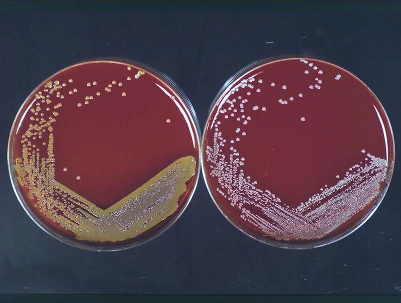 Staphylococcus aureus and Staphyloccocus epidermidis