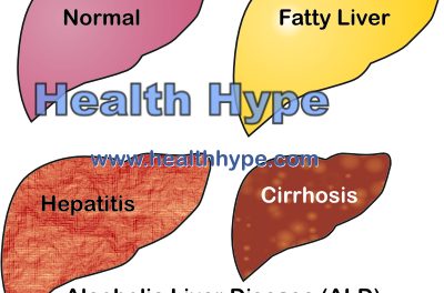 unhealthy liver